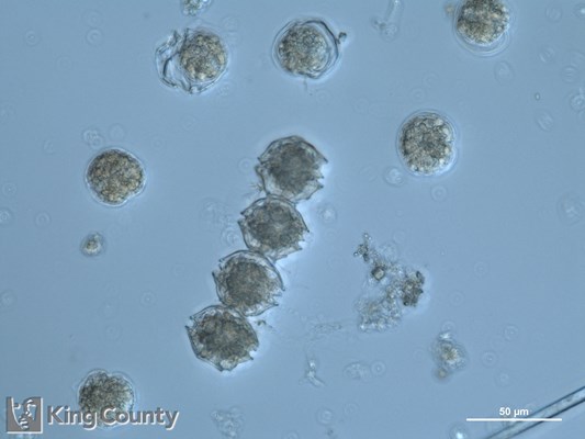 Photo of Alexandrium catenella